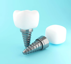 implant uygulamaları